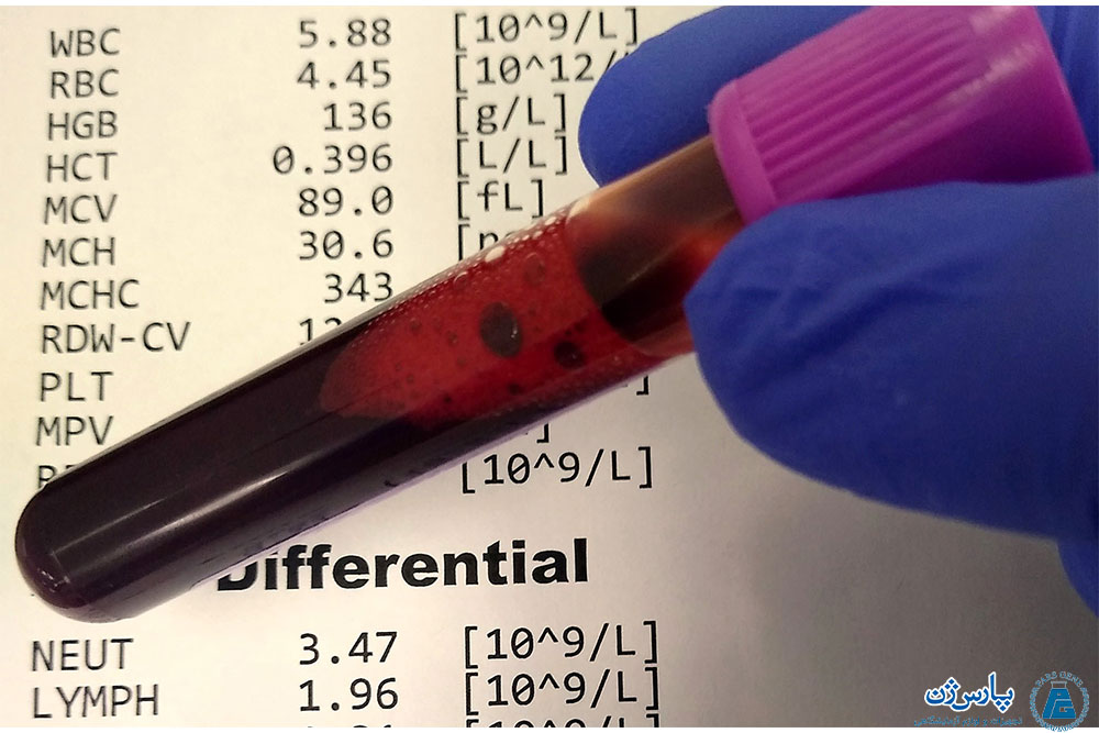 آزمایش خون cbc