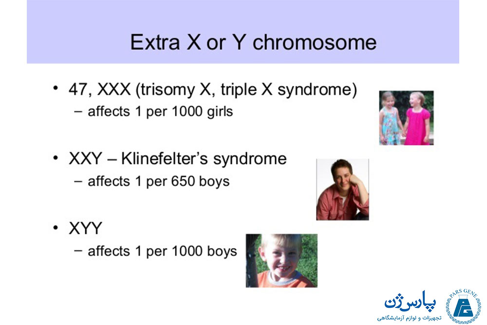 سندرم کروموزوم‌های X و Y اضافی
